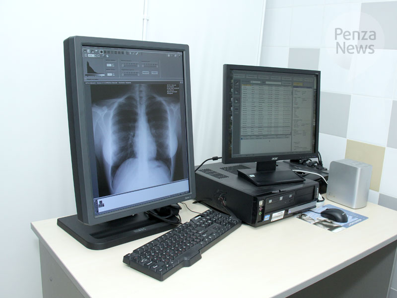 В белинской районной больнице установлен новый рентген-аппарат